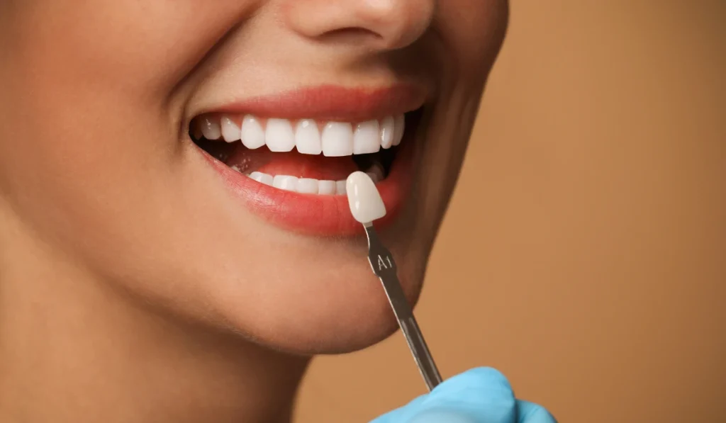 Dentist holding a tooth shade sample beside a patient’s veneers