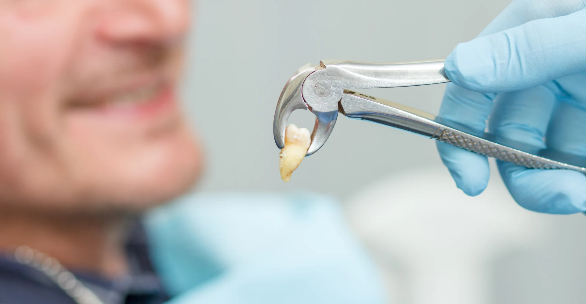 Dentist holds an extracted tooth with forceps.